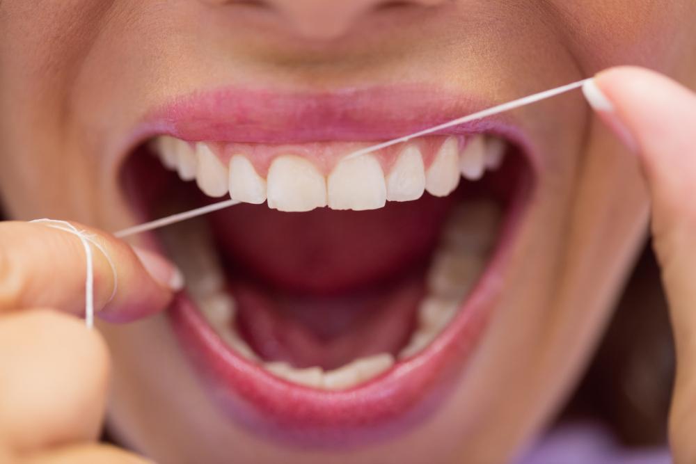 Corrigindo gengivas em contato com implantes dentários.