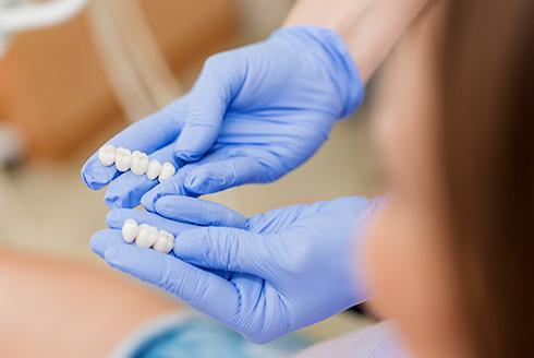 Facetas de porcelana e lentes de contato: qual a diferença?